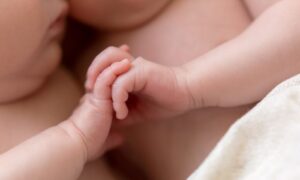 2014年、1絨毛膜1羊膜双胎が手をつないで誕生　双子の現在について