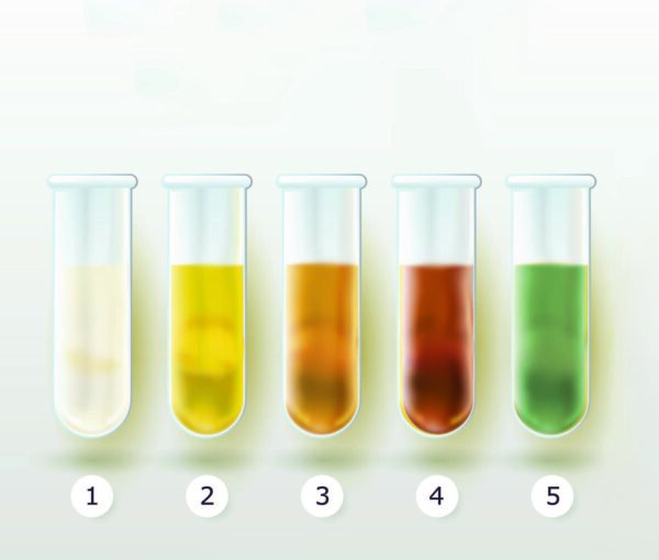 尿が語る健康 5つの色が教えてくれるもの