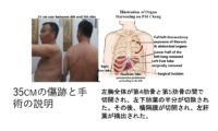 証言が明かす弾圧の現実　法輪功学習者たちの声　東京で響く