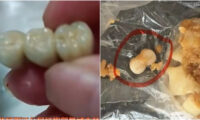 人の歯入りソーセージ　人の歯入りシュウマイ　「遺体再利用」の噂は本当だった？＝中国【動画あり】