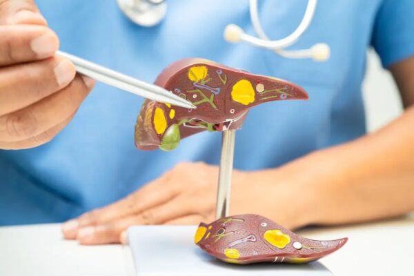 脂肪肝は心臓病の危険因子　肝と心臓を守る方法