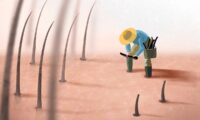 植毛を受ける前に知っておきたい5つのこと