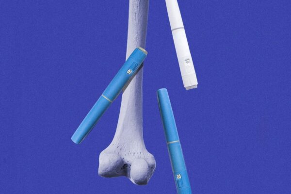 体重減少薬が骨の健康リスクに関連　5年間のデータで判明