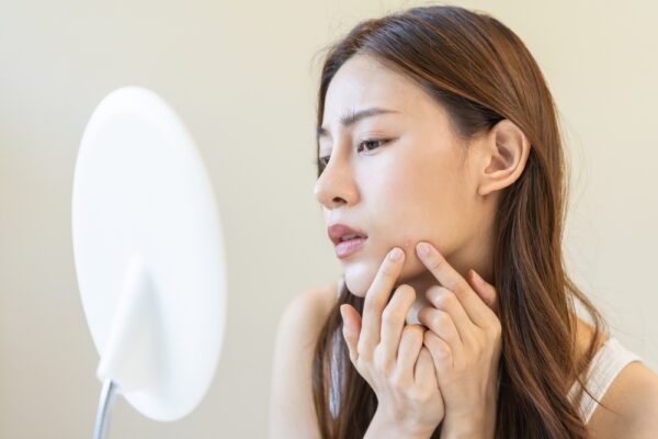 思春期を過ぎてもニキビが止まらない？　中医学で見る全身ケア